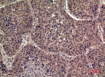 IL-1F8 rabbit pAb Antibody