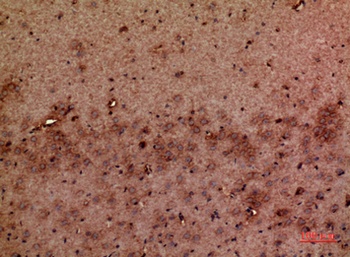 GMF-β rabbit pAb Antibody