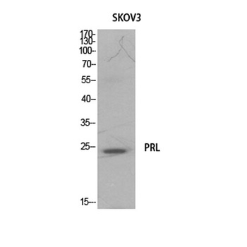 Prolactin rabbit pAb Antibody