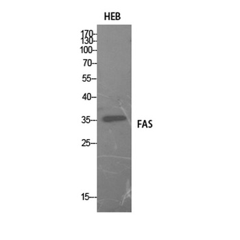FAS rabbit pAb Antibody