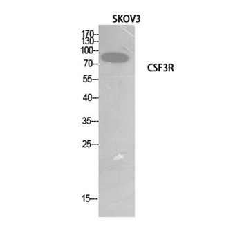 G-CSFR rabbit pAb Antibody