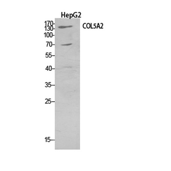 COL5A2 rabbit pAb Antibody