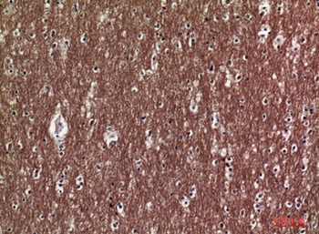 COL5A2 rabbit pAb Antibody