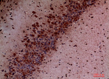 PI 3-Kinase p110δ rabbit pAb Antibody