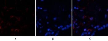 Ub rabbit pAb Antibody