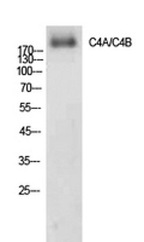C4a/b rabbit pAb Antibody