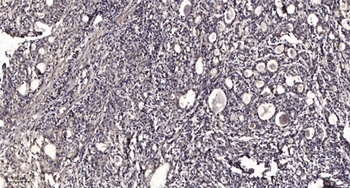 Stra8 rabbit pAb Antibody
