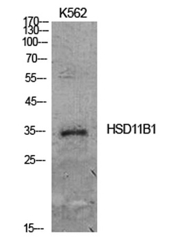 11β-HSD1 rabbit pAb Antibody