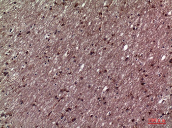 11β-HSD1 rabbit pAb Antibody