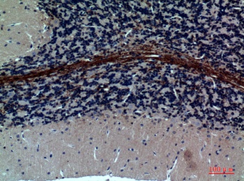 GABAA Rα1 rabbit pAb Antibody