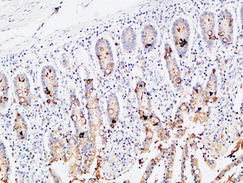 IL-3Rα rabbit pAb Antibody