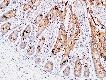 IL-3Rα rabbit pAb Antibody