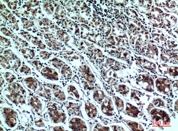 PPP1R15B rabbit pAb Antibody