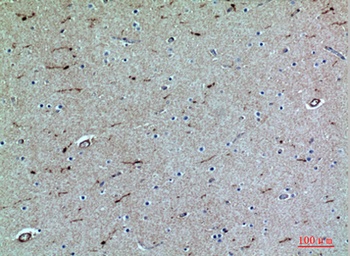 PSGL-1 rabbit pAb Antibody