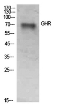 GHR rabbit pAb Antibody