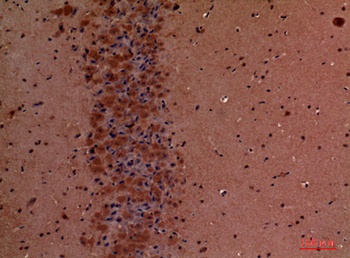 Talin-1 rabbit pAb Antibody