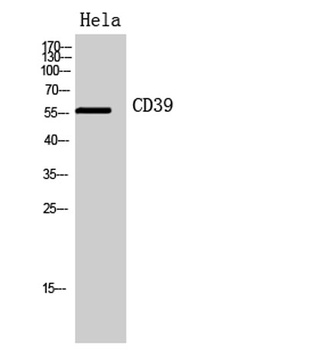 CD39 rabbit pAb Antibody