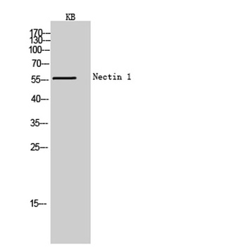 Nectin 1 rabbit pAb Antibody