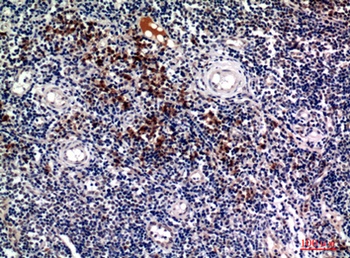 CD138 rabbit pAb Antibody