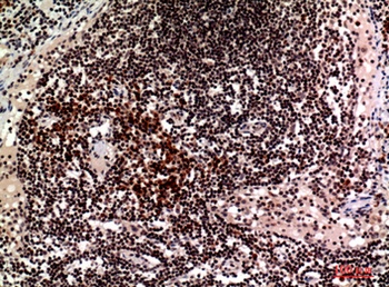 CD244 rabbit pAb Antibody