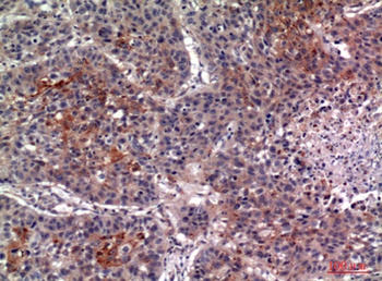 IL-13Rα2 rabbit pAb Antibody