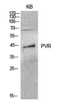 CD155 rabbit pAb Antibody