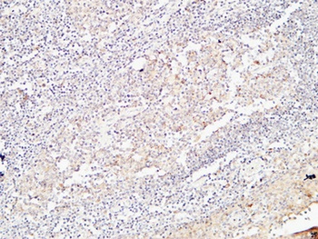 BMP-15 rabbit pAb Antibody
