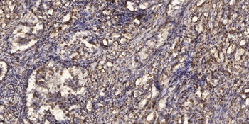 MIP-1b rabbit pAb Antibody