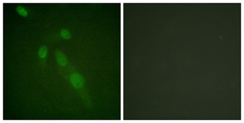 Acetyl Lys proteins rabbit pAb Antibody