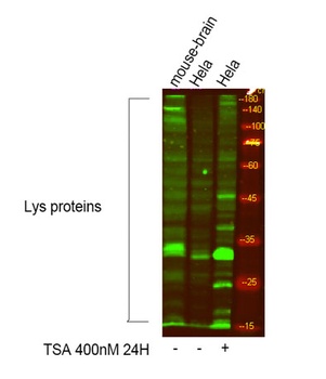 Acetyl Lys proteins rabbit pAb Antibody