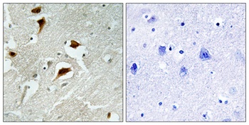 4E-BP1 (phospho Thr69) rabbit pAb Antibody