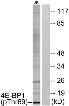 4E-BP1 (phospho Thr69) rabbit pAb Antibody
