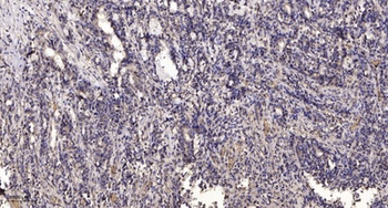 Tie-2 (phospho Tyr992) rabbit pAb Antibody