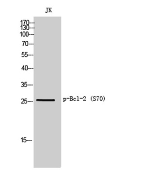 Bcl-2 (phospho Ser70) rabbit pAb Antibody