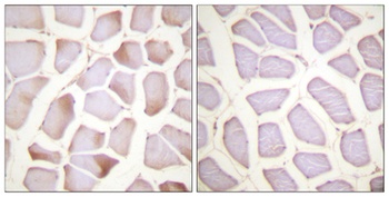 Troponin I-C (phospho Ser22/S23) rabbit pAb