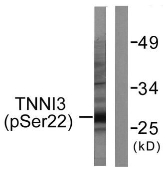 Troponin I-C (phospho Ser22/S23) rabbit pAb