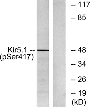KIR5.1 (phospho Ser416) rabbit pAb Antibody