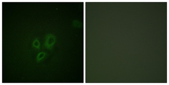Troponin I-C rabbit pAb