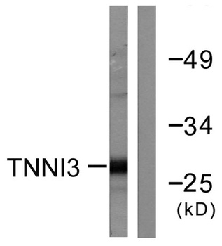 Troponin I-C rabbit pAb
