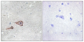 P-cadherin rabbit pAb Antibody