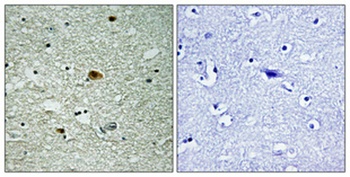 HDAC6 (phospho Ser22) rabbit pAb Antibody