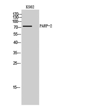 PARP-2 rabbit pAb Antibody