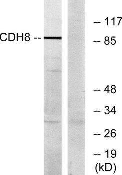 Cadherin-8 rabbit pAb Antibody