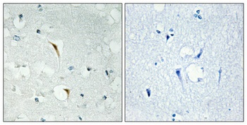 DEF-3 rabbit pAb Antibody