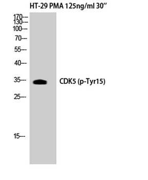 Cdk5 (phospho Tyr15) rabbit pAb Antibody