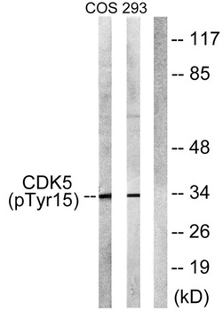 Cdk5 (phospho Tyr15) rabbit pAb Antibody
