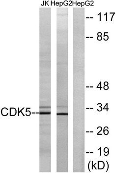 Cdk5 rabbit pAb Antibody