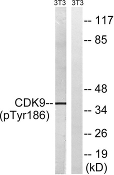Cdk9 (phospho Thr186) rabbit pAb Antibody