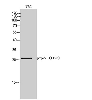 p27 (phospho Thr198) rabbit pAb Antibody