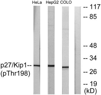 p27 (phospho Thr198) rabbit pAb Antibody